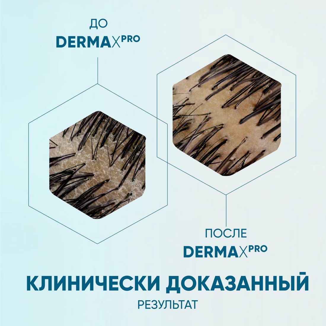 Бальзам Head & Shoulders Derma Xpro Ревитализация кожи головы 220 мл